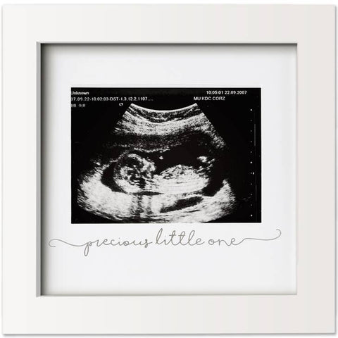 Solo Baby Sonogram Picture Frame